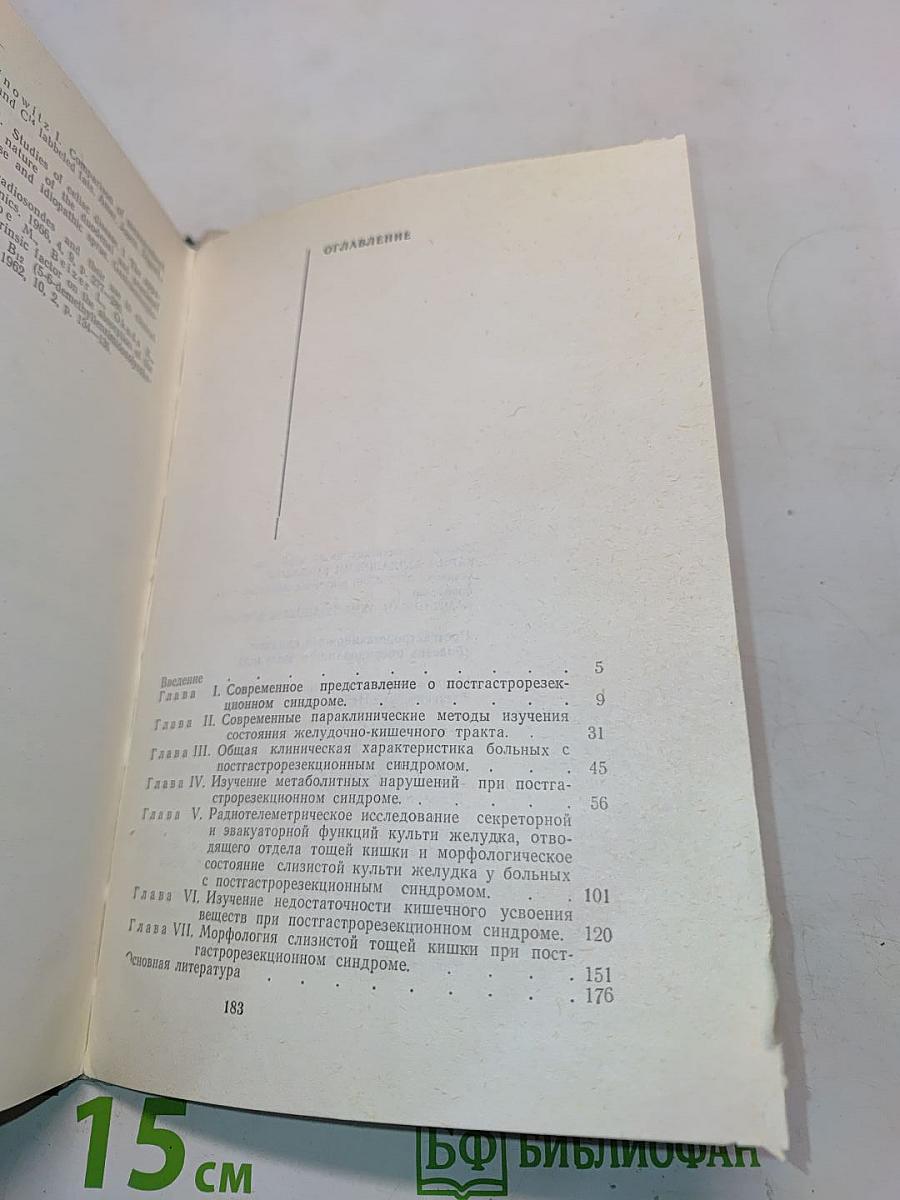 Постгастрорезекционный синдром