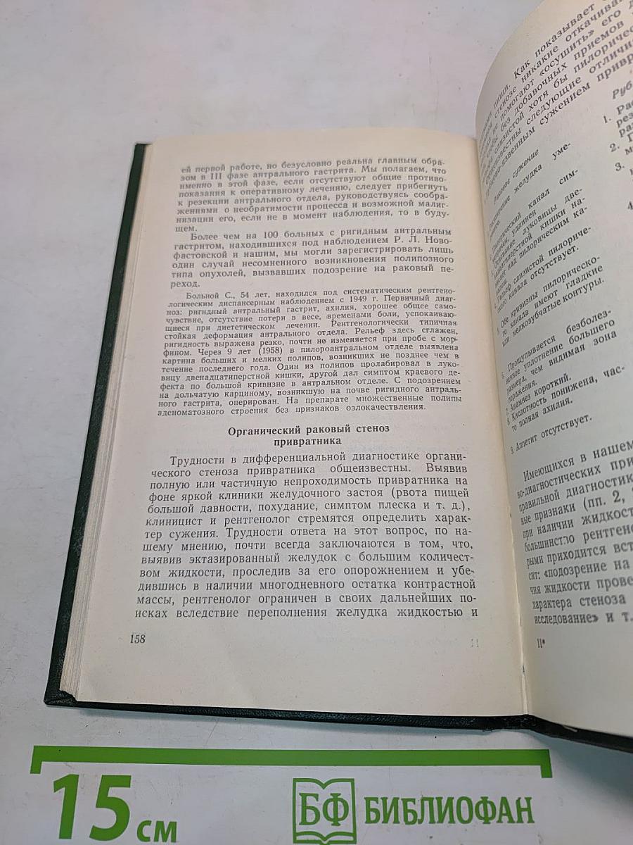 Ошибки и трудности в рентгенодиагностике рака желудка