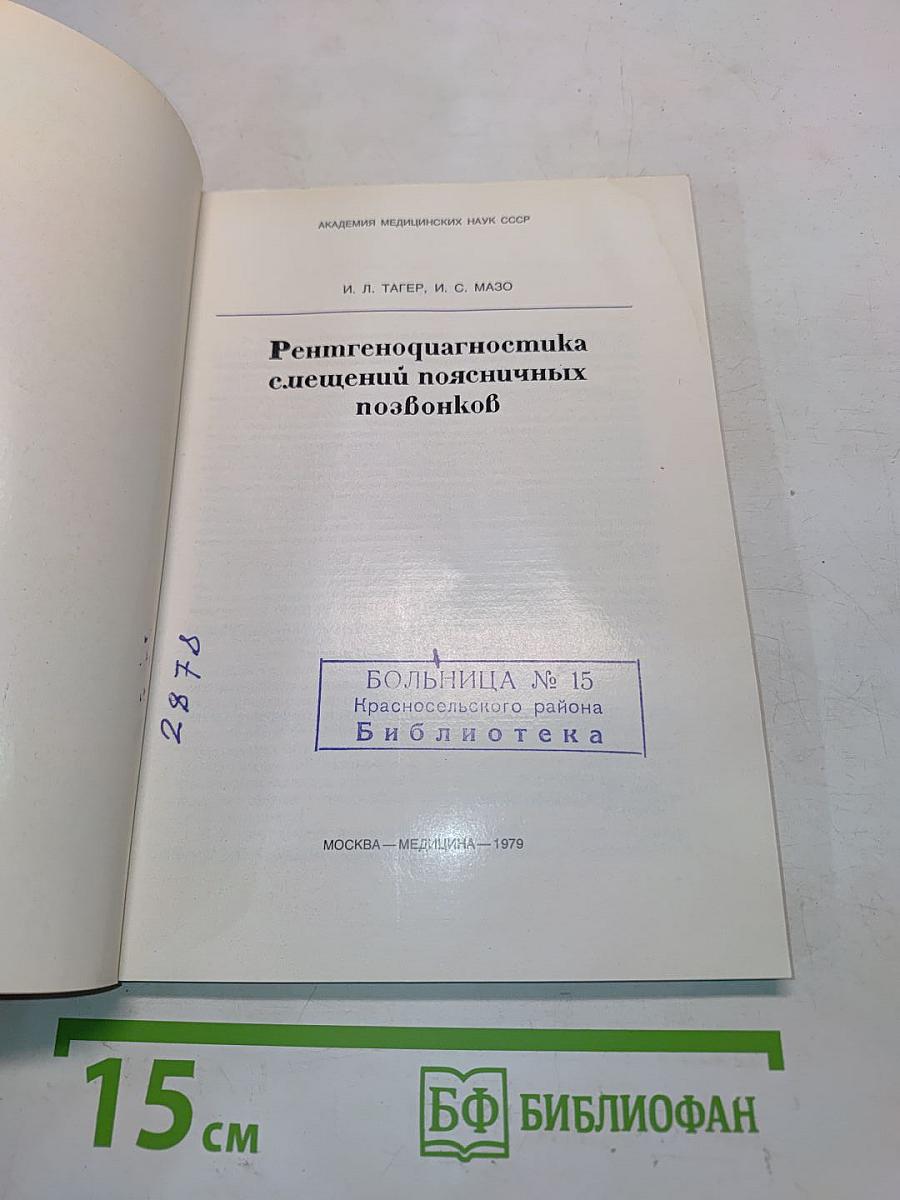 Рентгенодиагностика смещений поясничных позвонков
