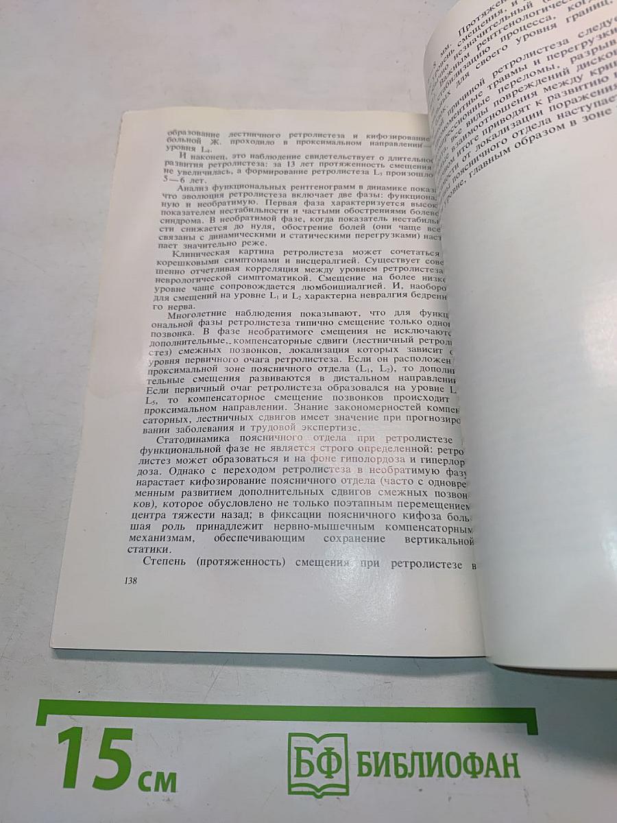 Рентгенодиагностика смещений поясничных позвонков