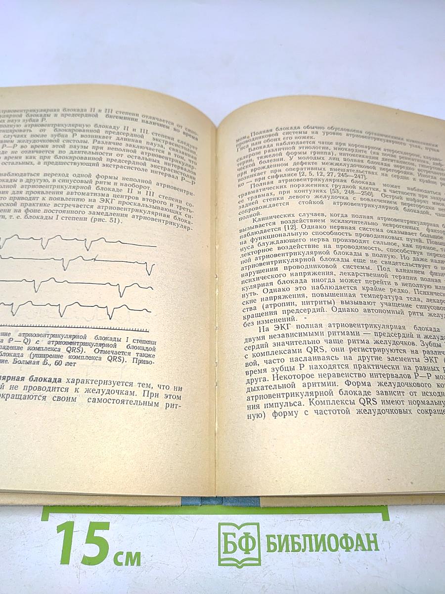 Практическое руководство по электрокардиографии. Часть 2