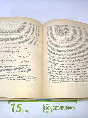 Практическое руководство по электрокардиографии. Часть 2