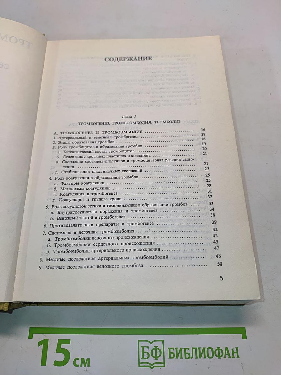 Тромбозы и эмболии при сердечно-сосудистых заболеваниях