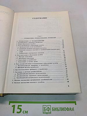 Тромбозы и эмболии при сердечно-сосудистых заболеваниях