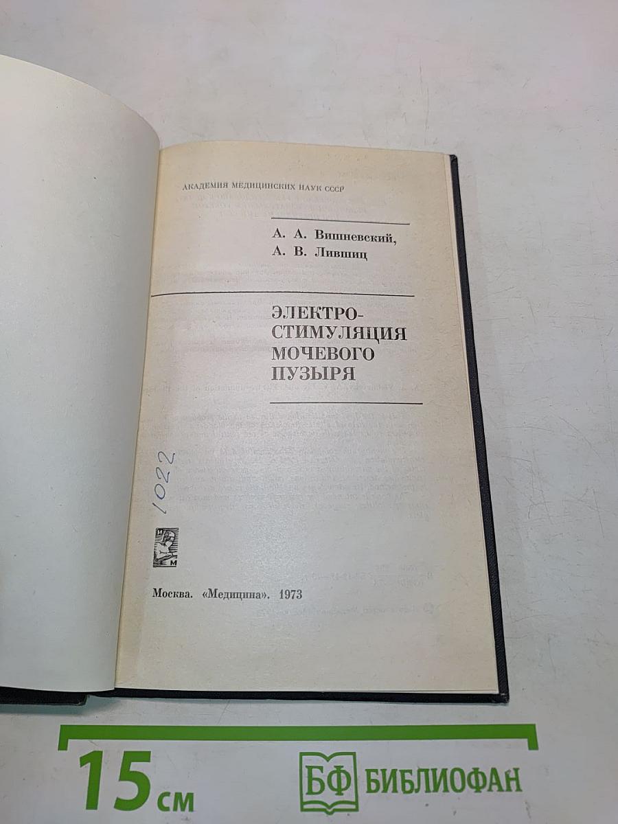 Электростимуляция мочевого пузыря