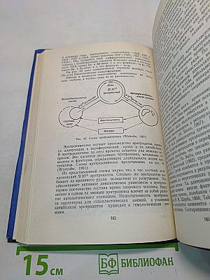 Гемолитические анемии у детей
