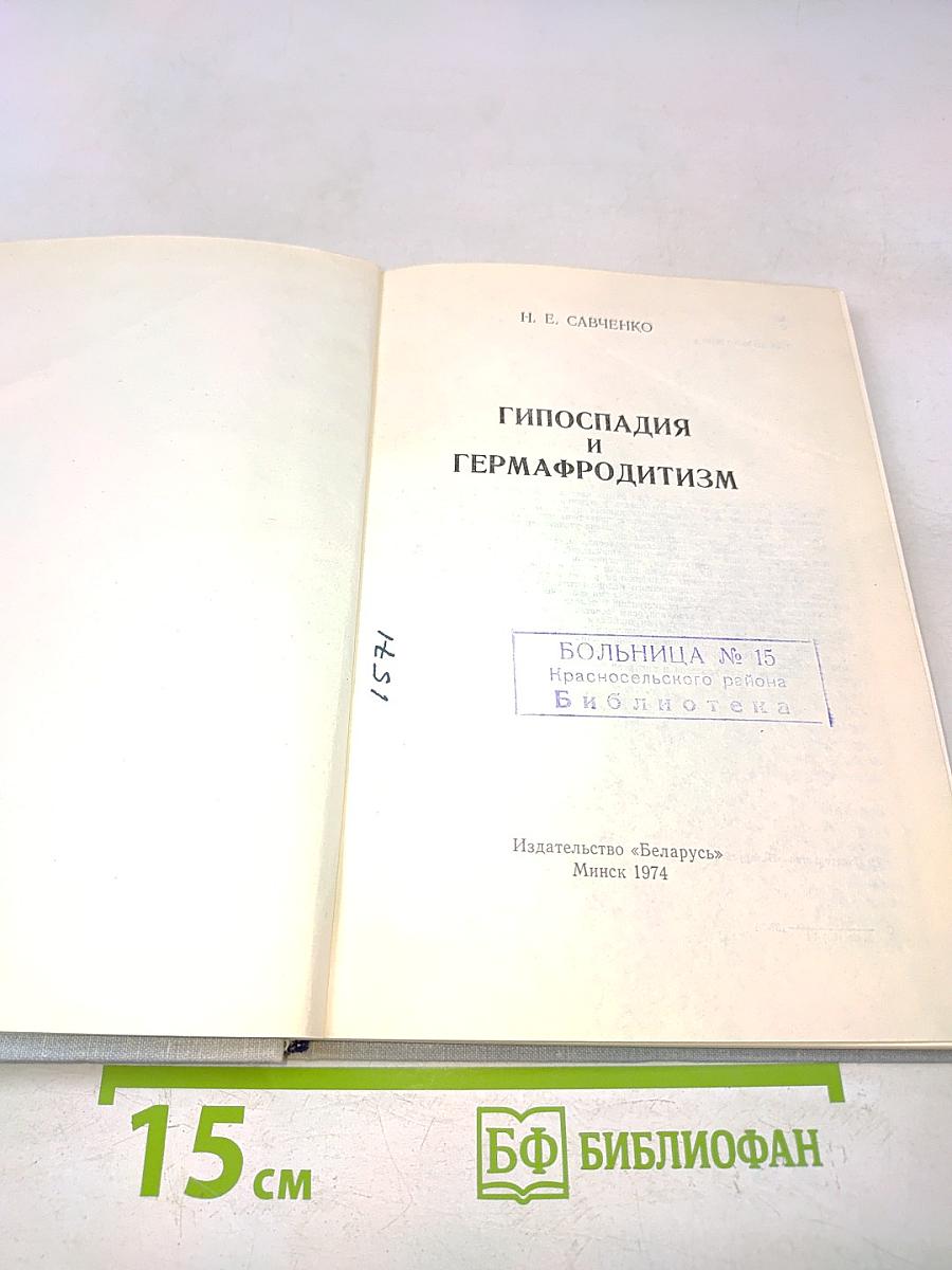 Гипоспадия и гермафродитизм