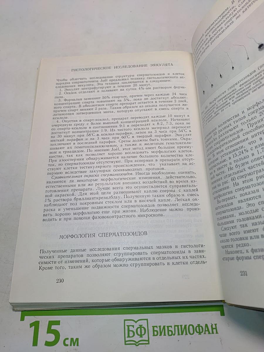 Бесплодие в семье