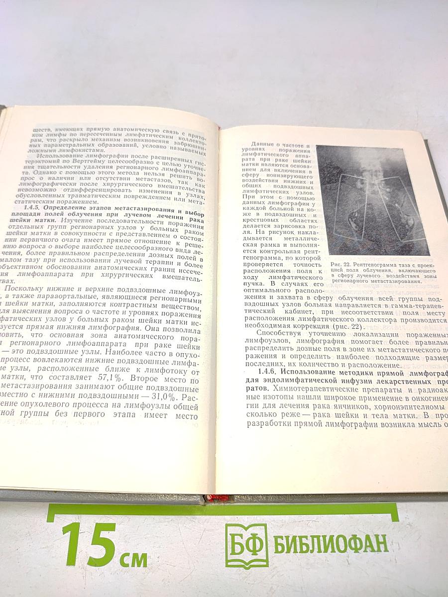 Справочник по онкогинекологии