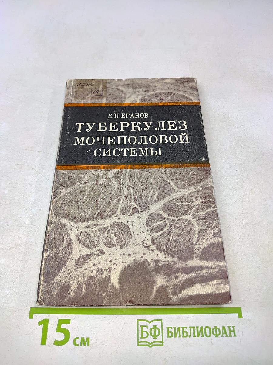 Туберкулез мочеполовой системы