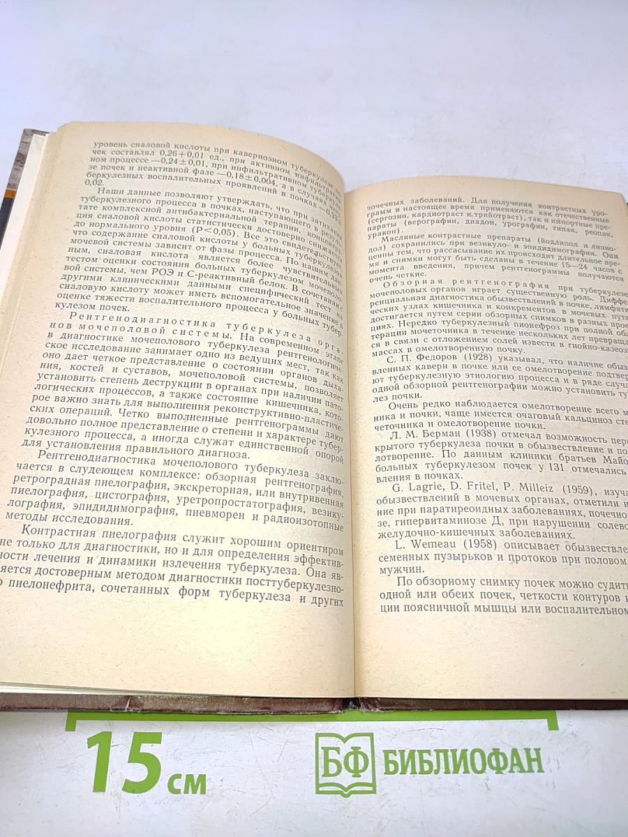 Туберкулез мочеполовой системы