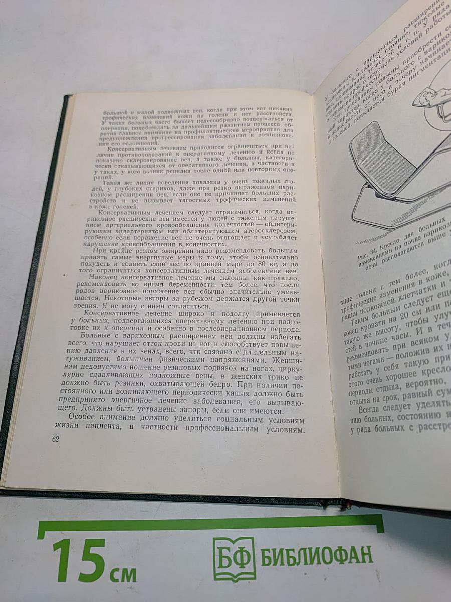 Варикозное расширение вен нижних конечностей