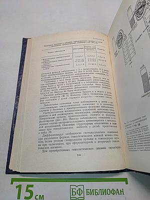 Гемолитические анемии у детей