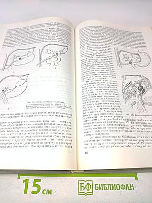 Хирургическая гепатология