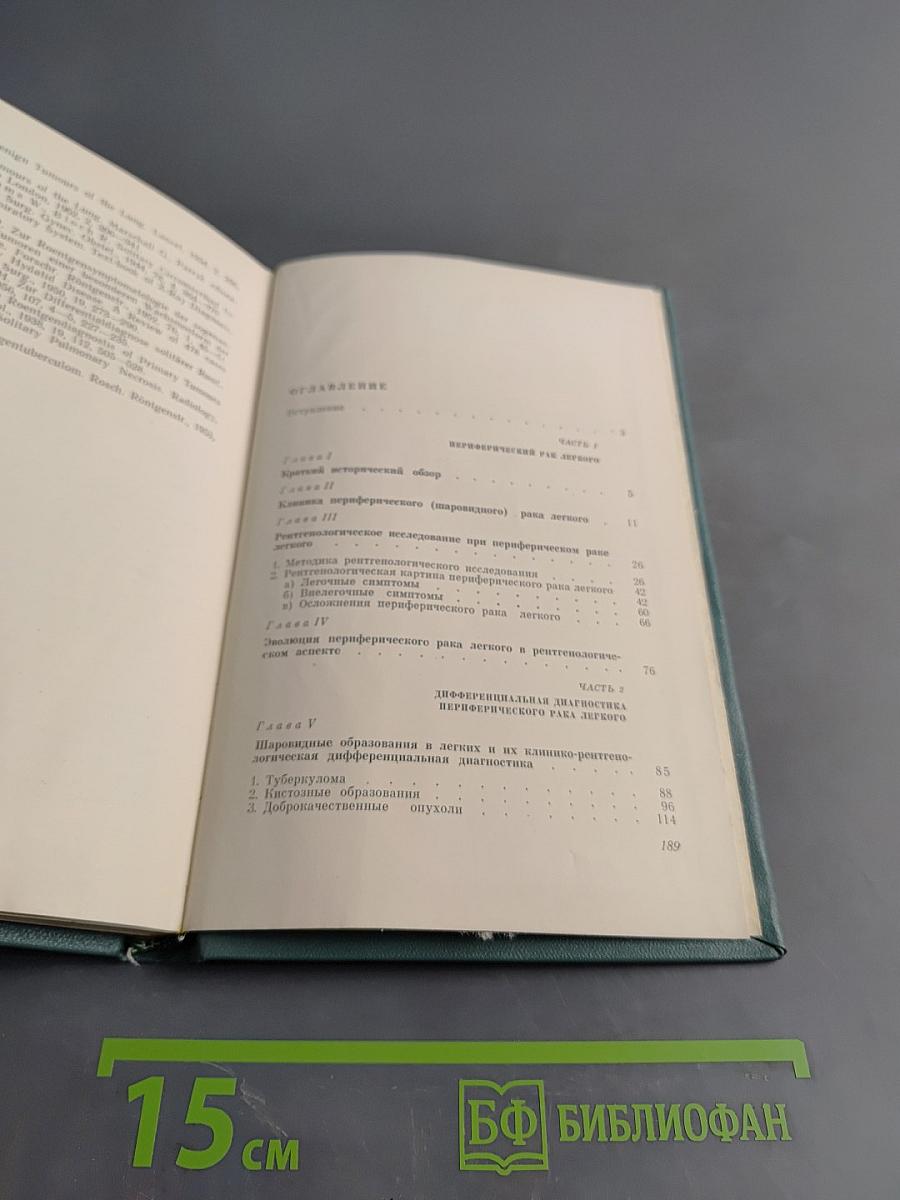Периферический рак и шаровидные образования в легких
