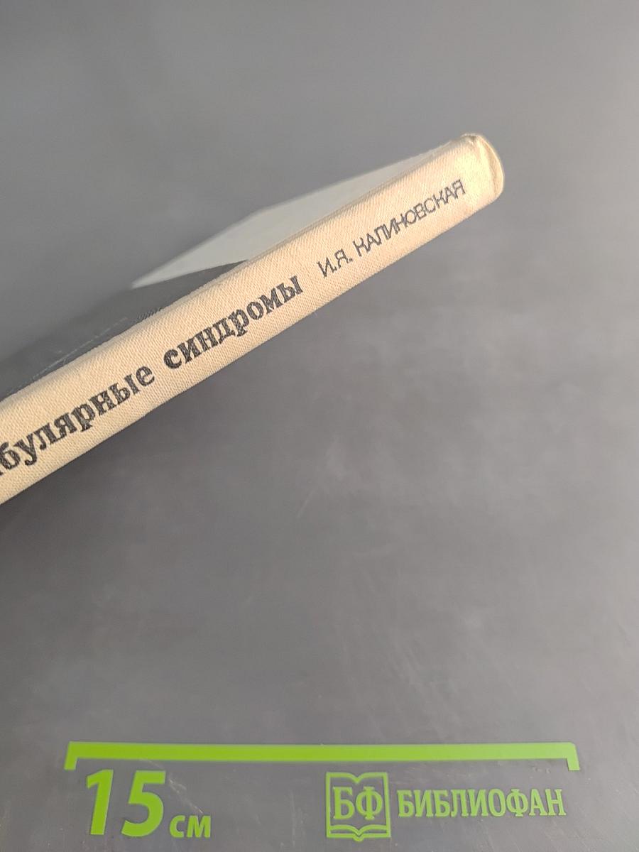 Стволовые вестибулярные синдромы
