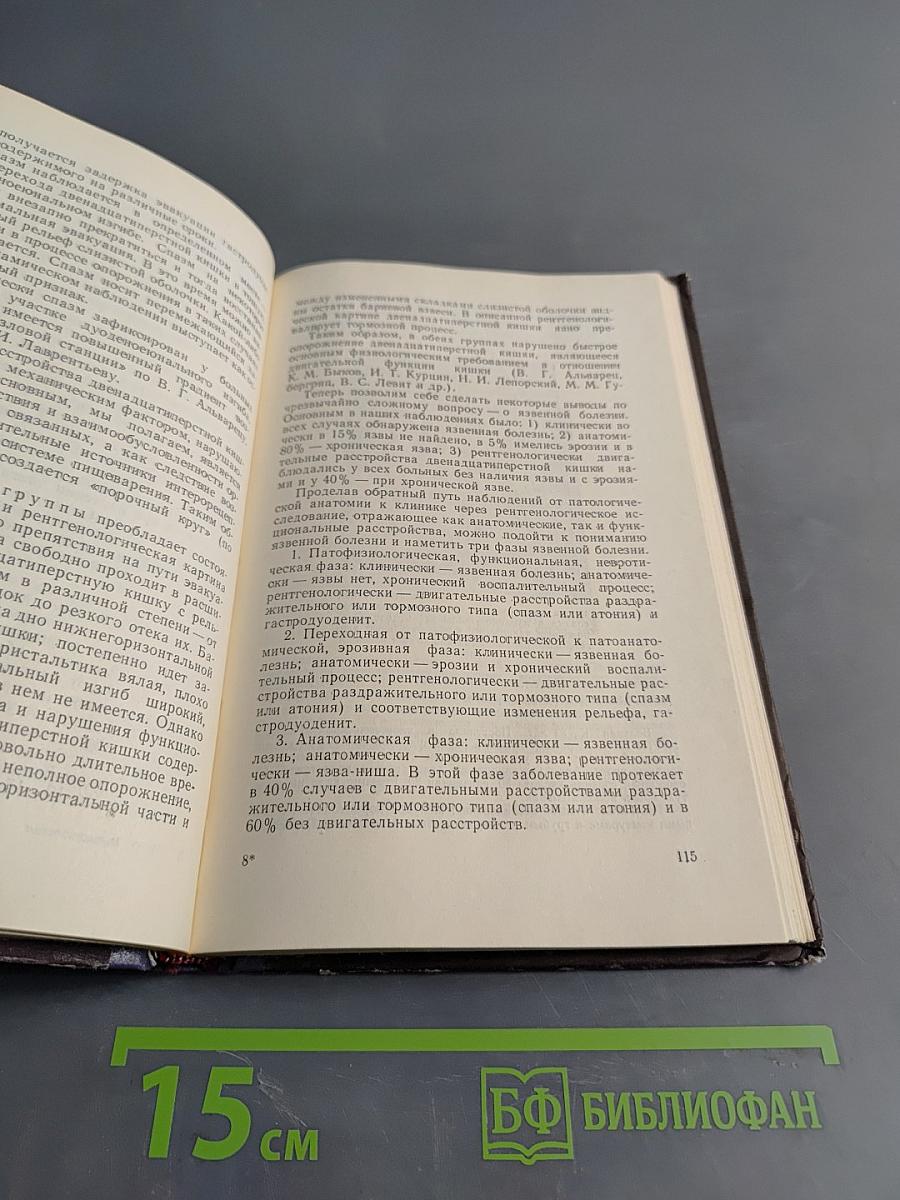 Рентгенодиагностика заболеваний двенадцатиперстной кишки