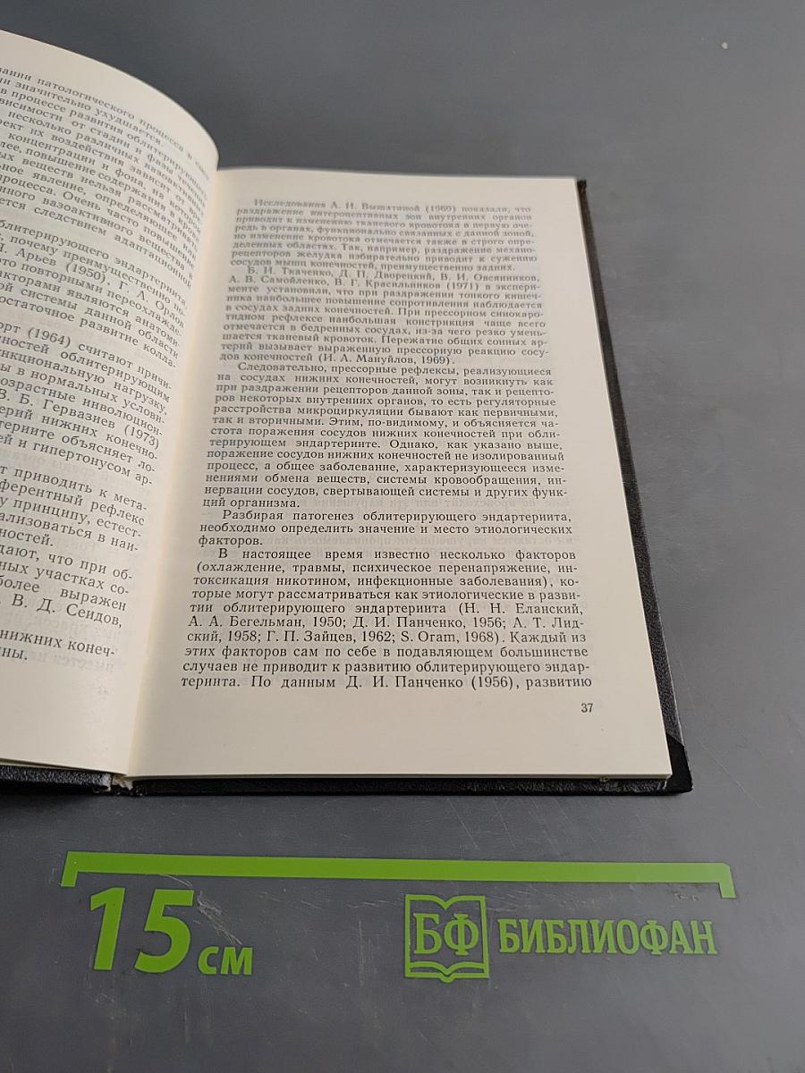 Тромбооблитерирующие заболевания артерий нижних конечностей