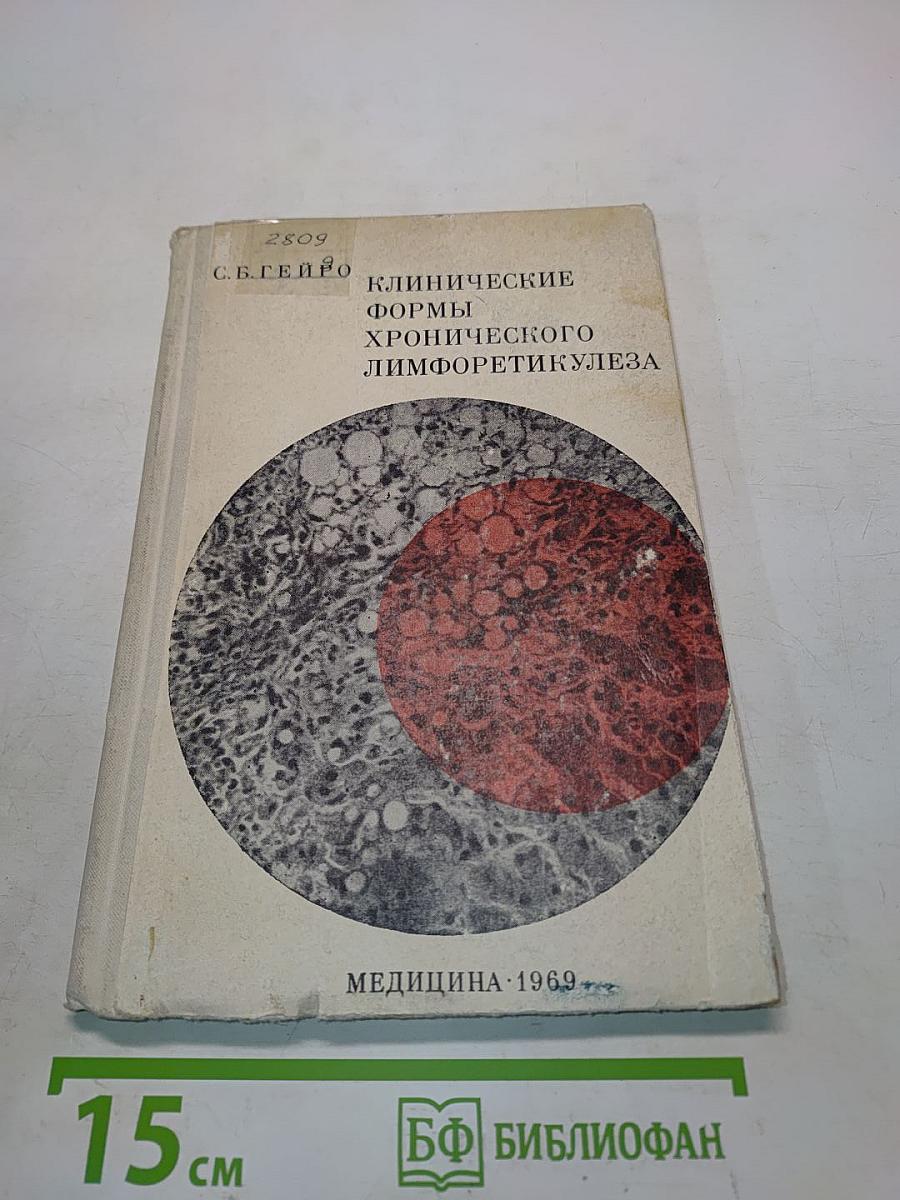 Клинические формы хронического лимфоретикулеза