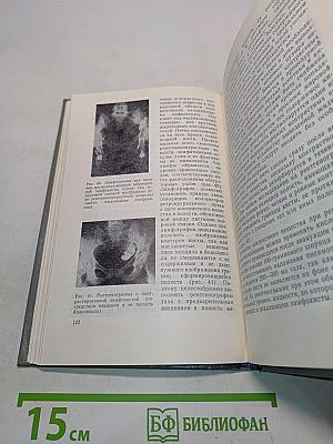 Справочник по онкогинекологии
