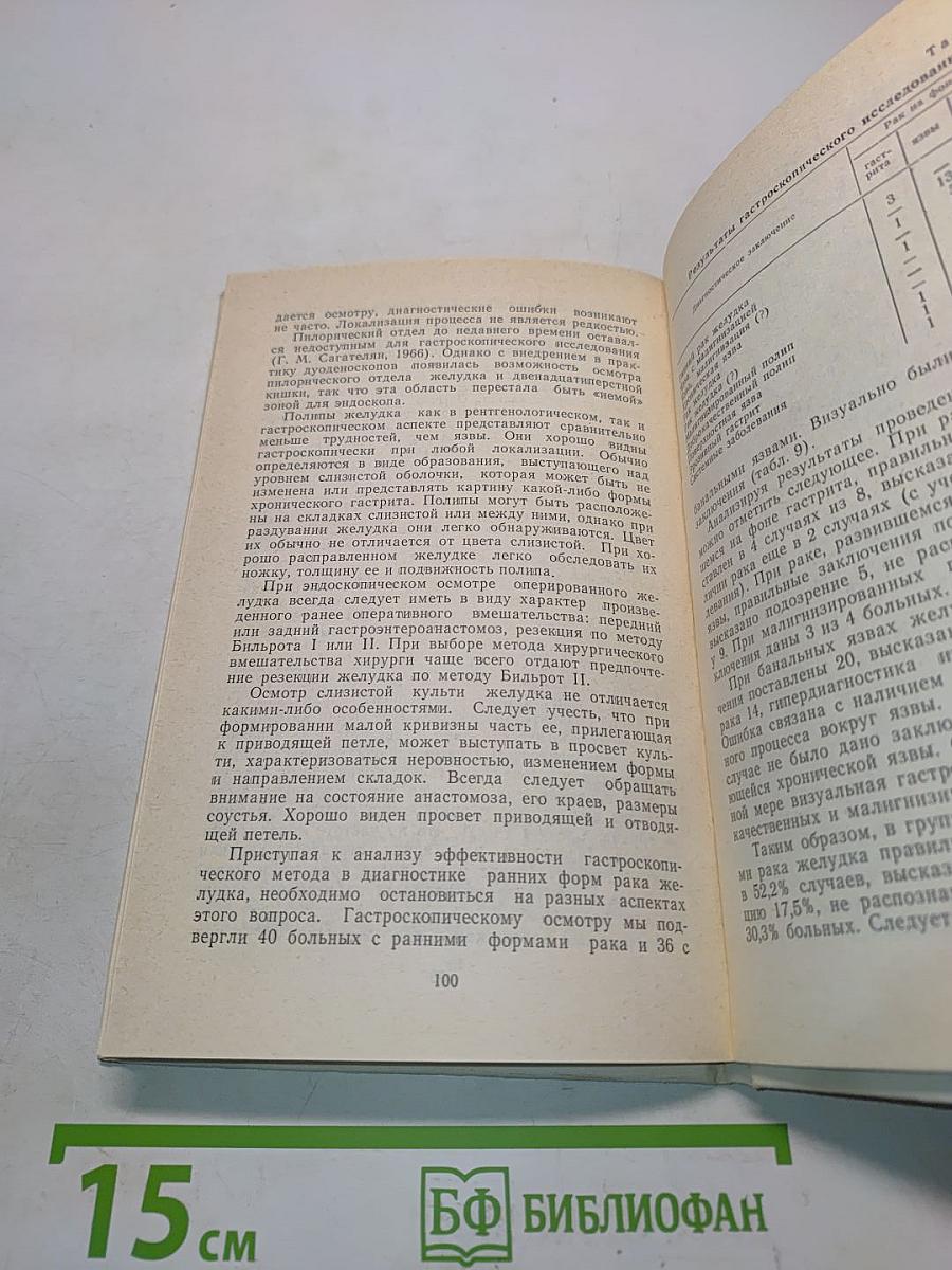 Клиническая и диагностика раннего рака желудка