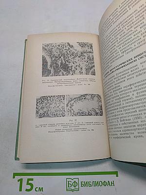 Эндокринная система при лейкозах и лимфогранулематозе