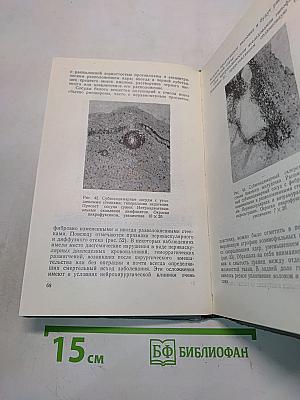 Хронические перивентрикулярные энцефалиты и арахноидиты