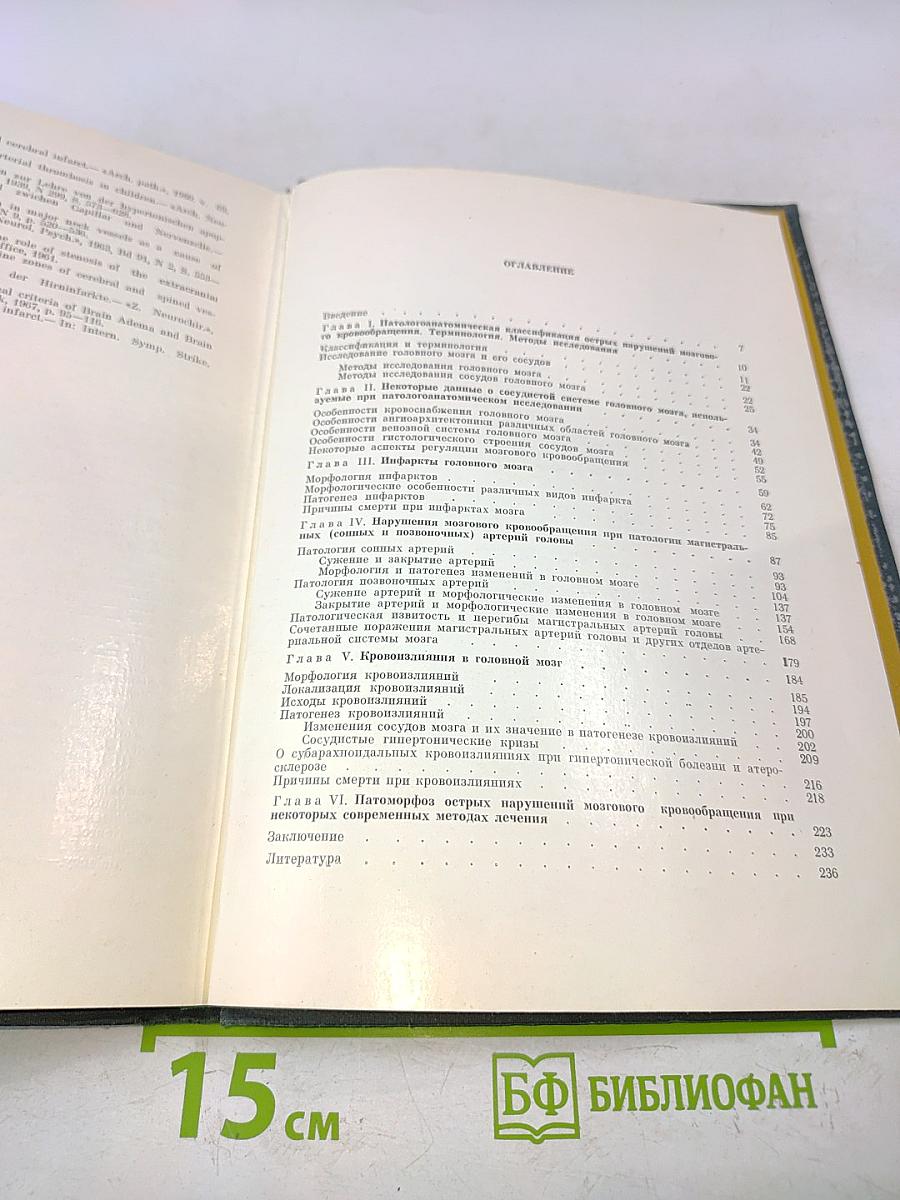 Патологическая анатомия нарушений мозгового кровообращения