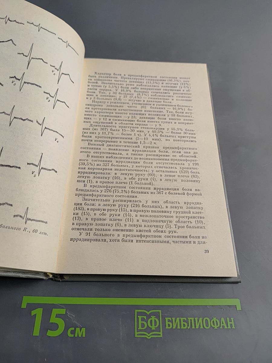 Предиинфарктное состояние
