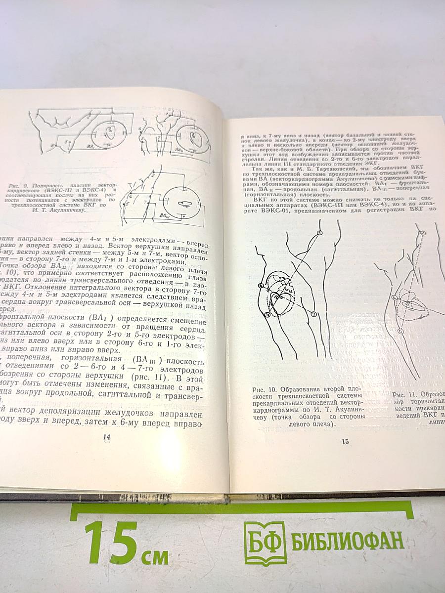 Изменения электро- и векторкардиограммы при гипертрофии миокарда