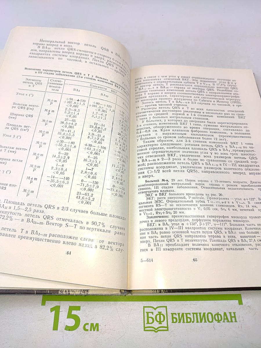 Изменения электро- и векторкардиограммы при гипертрофии миокарда