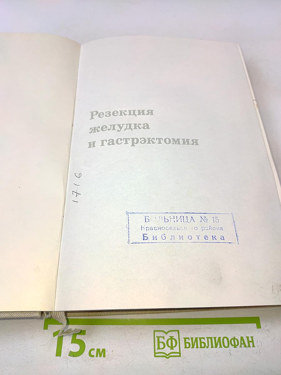 Резекция желудка и гастрэктомия