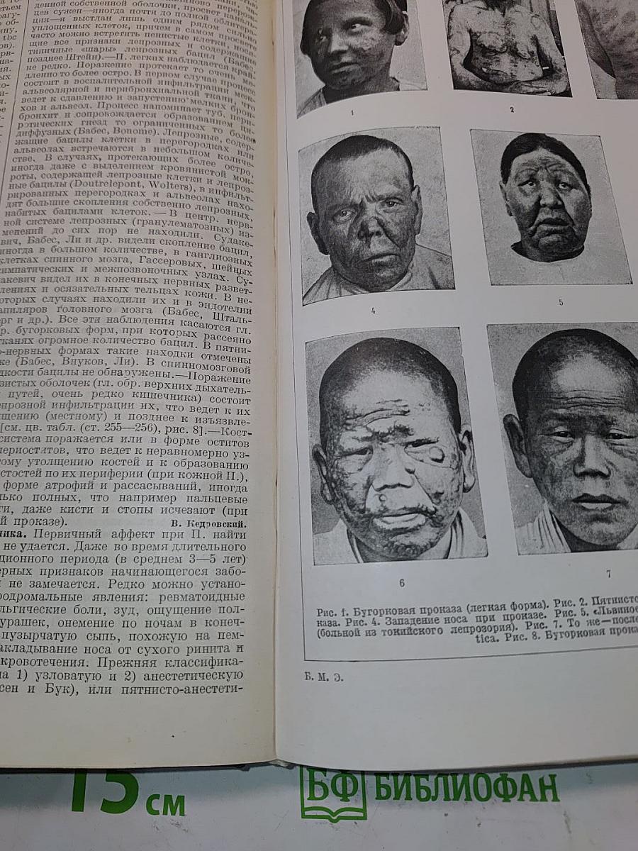 Большая медицинская энциклопедия. Том двадцать седьмой. Почкование — Псориаз