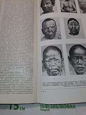 Большая медицинская энциклопедия. Том двадцать седьмой. Почкование — Псориаз