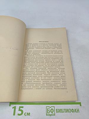 Изотопная миелография
