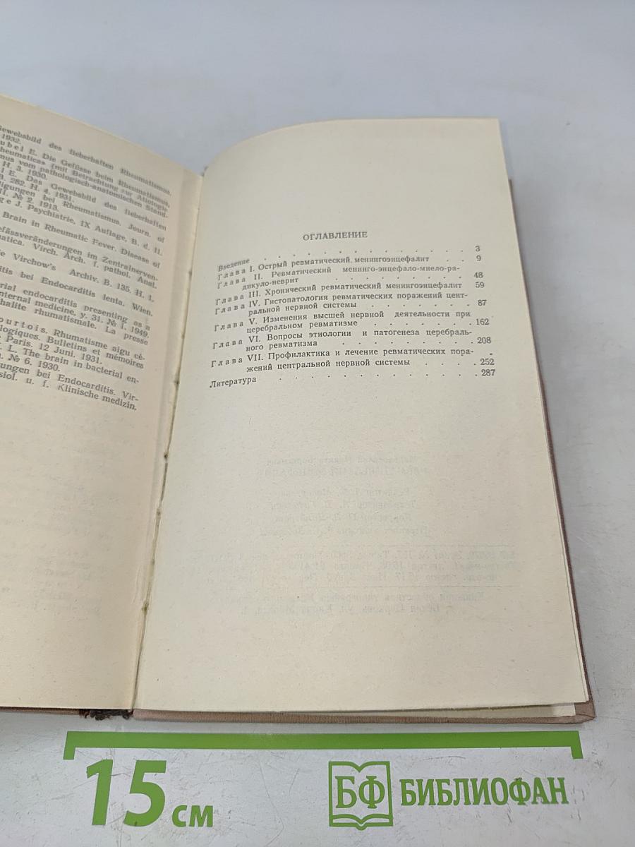 Ревматический энцефалит