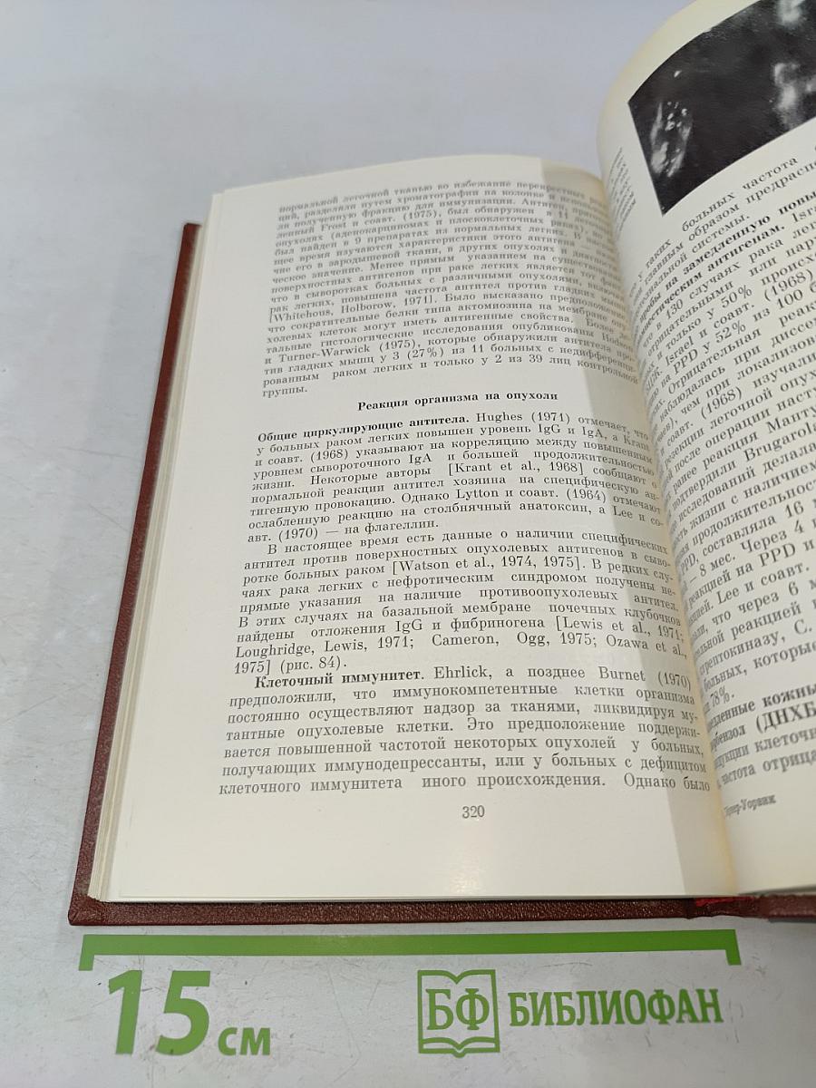 Иммунология легких
