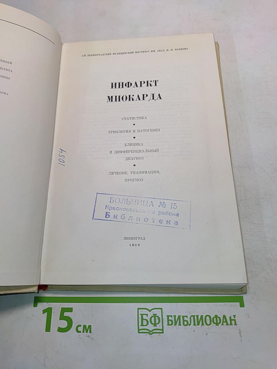 Инфаркт миокарда