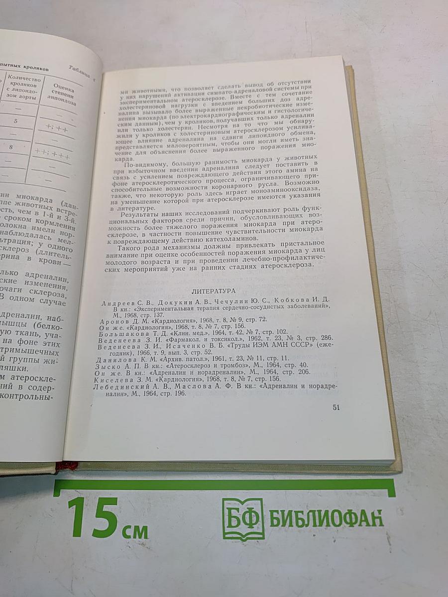 Инфаркт миокарда