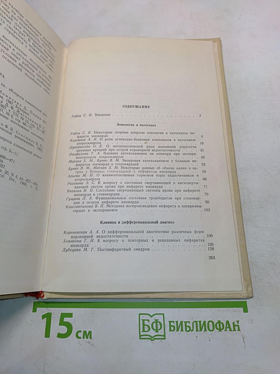 Инфаркт миокарда