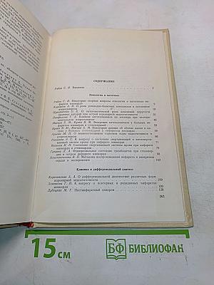 Инфаркт миокарда