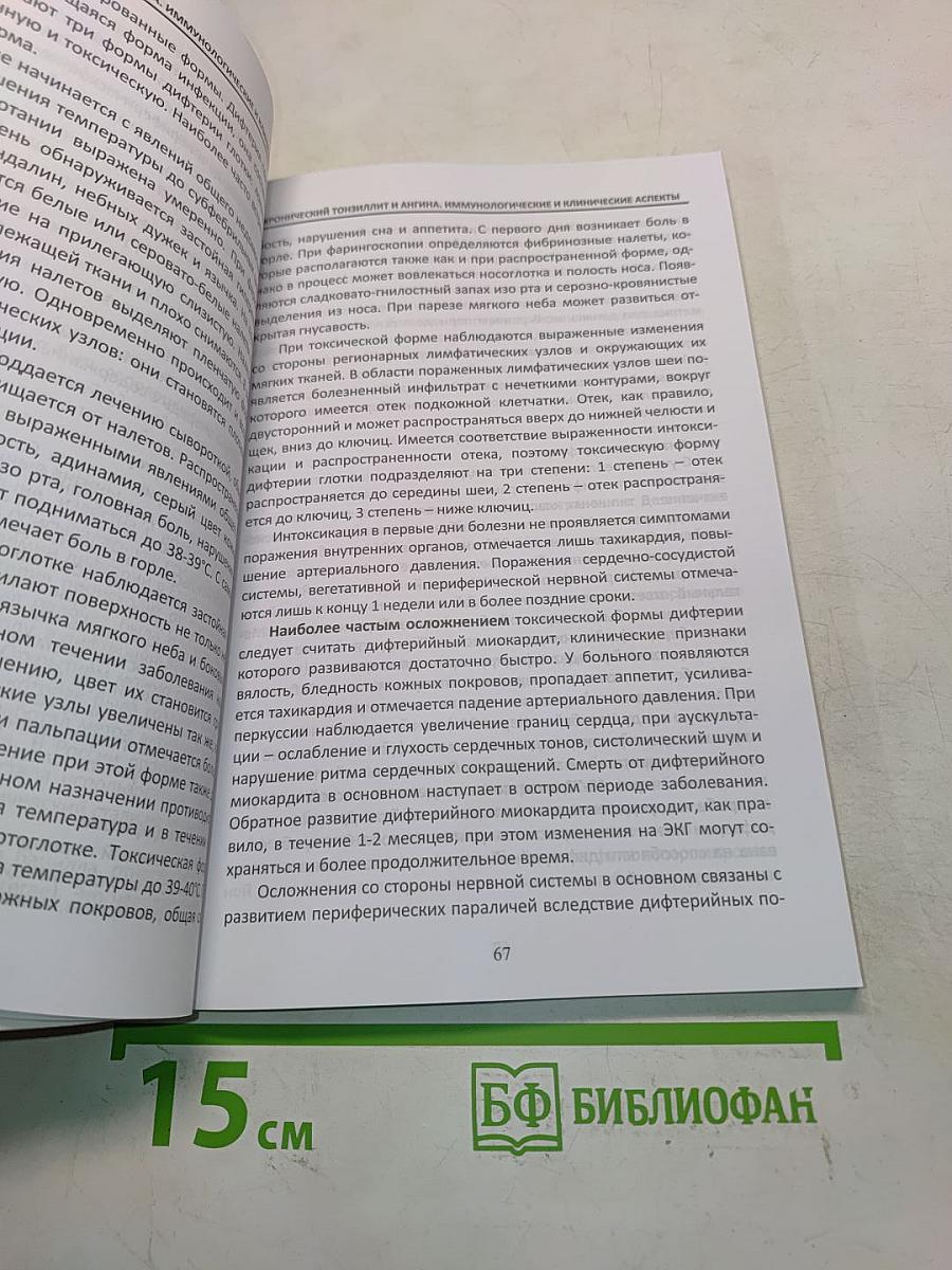 Хронический тонзиллит и ангина. Иммунологические и клинические аспекты