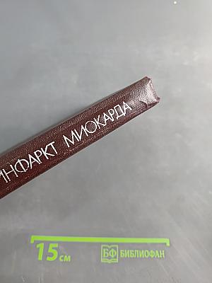 Инфаркт миокарда