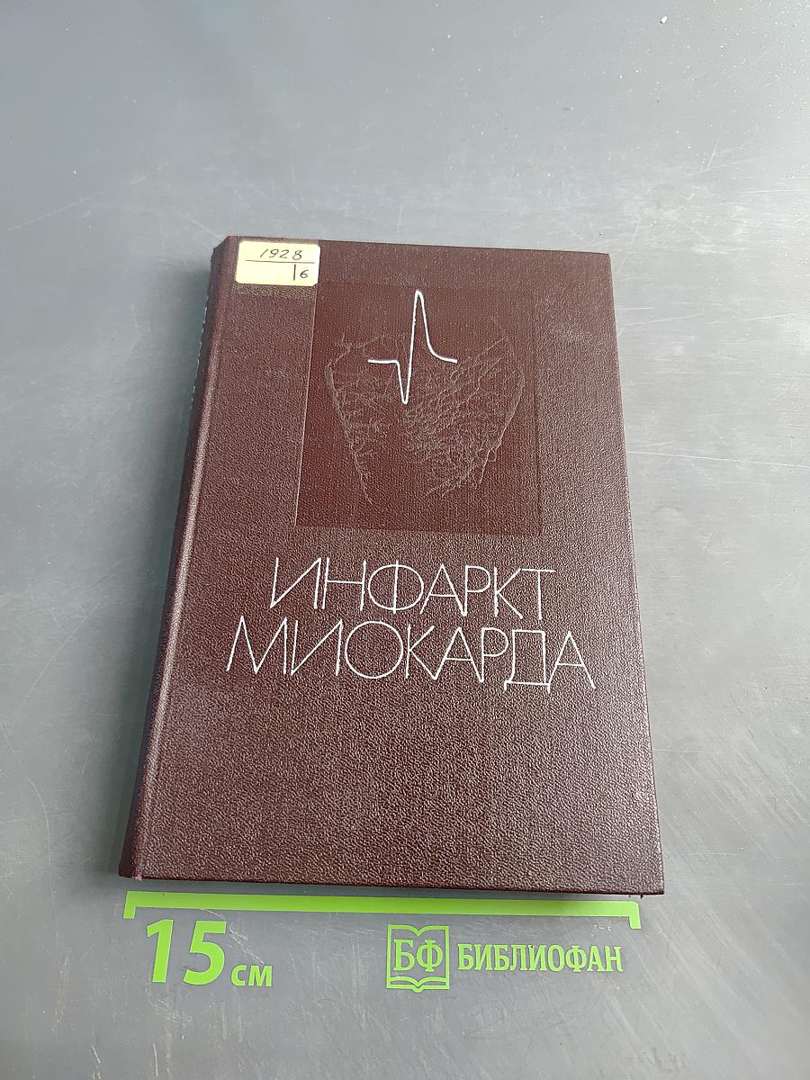 Инфаркт миокарда