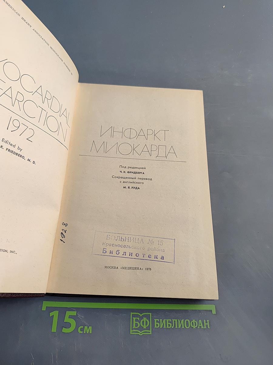 Инфаркт миокарда
