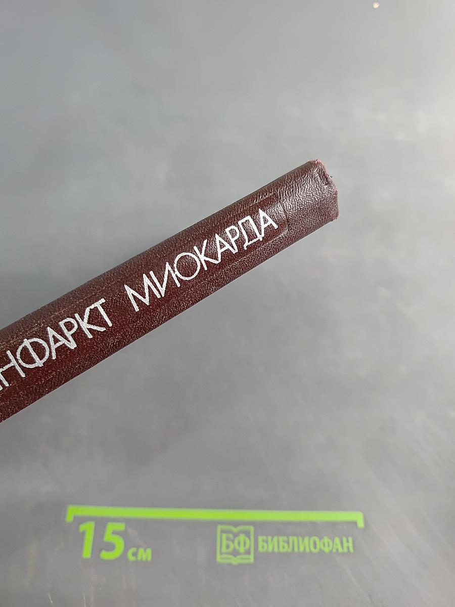 Инфаркт миокарда