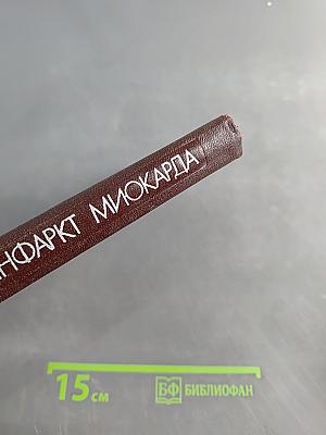 Инфаркт миокарда