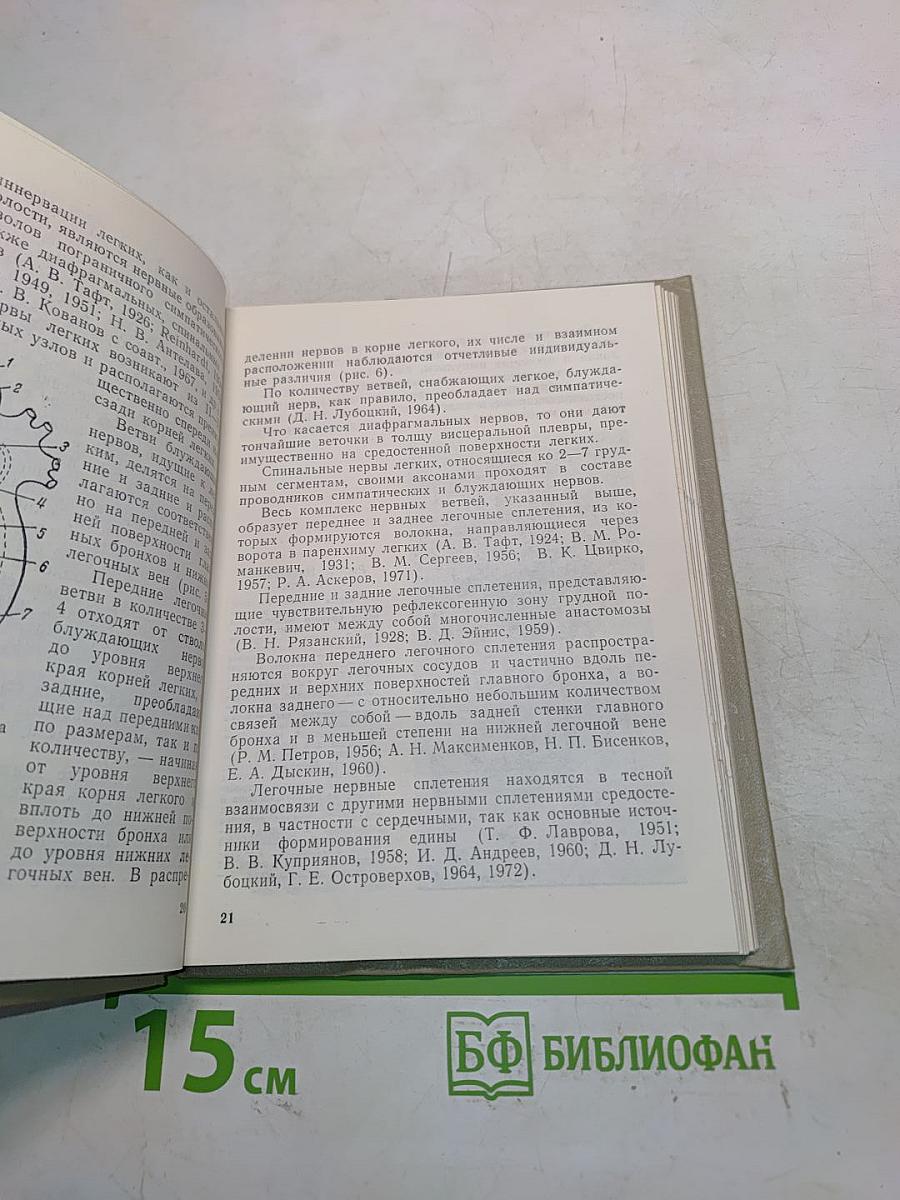Регионарная анестезия