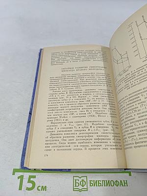 Гипертрофия миокарда и электромеханическая активность сердца