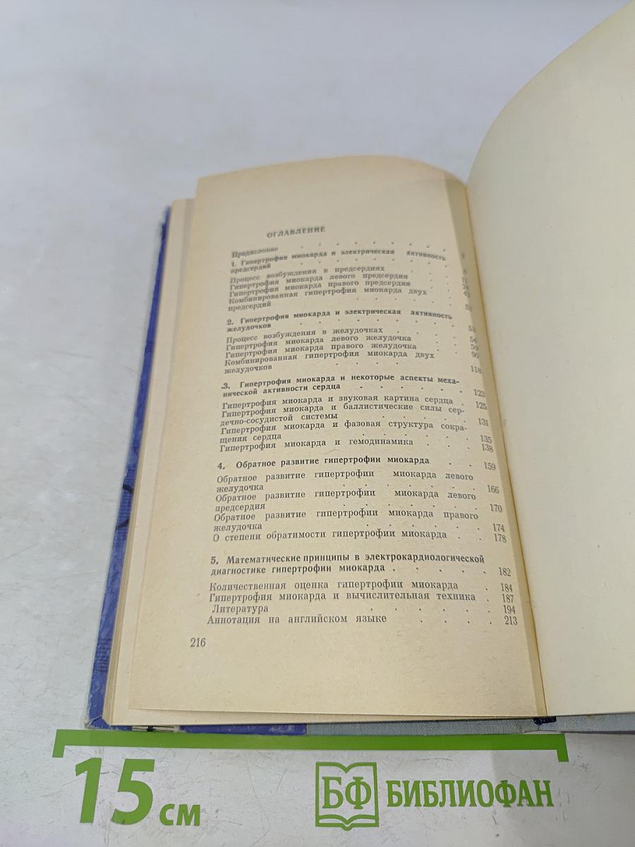 Гипертрофия миокарда и электромеханическая активность сердца